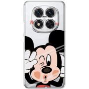 Прозорий чохол BoxFace Xiaomi Redmi Note 15 Pro Plus Mister M