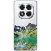 Прозорий чохол BoxFace Xiaomi Redmi Note 15 Pro Plus Green Mountain