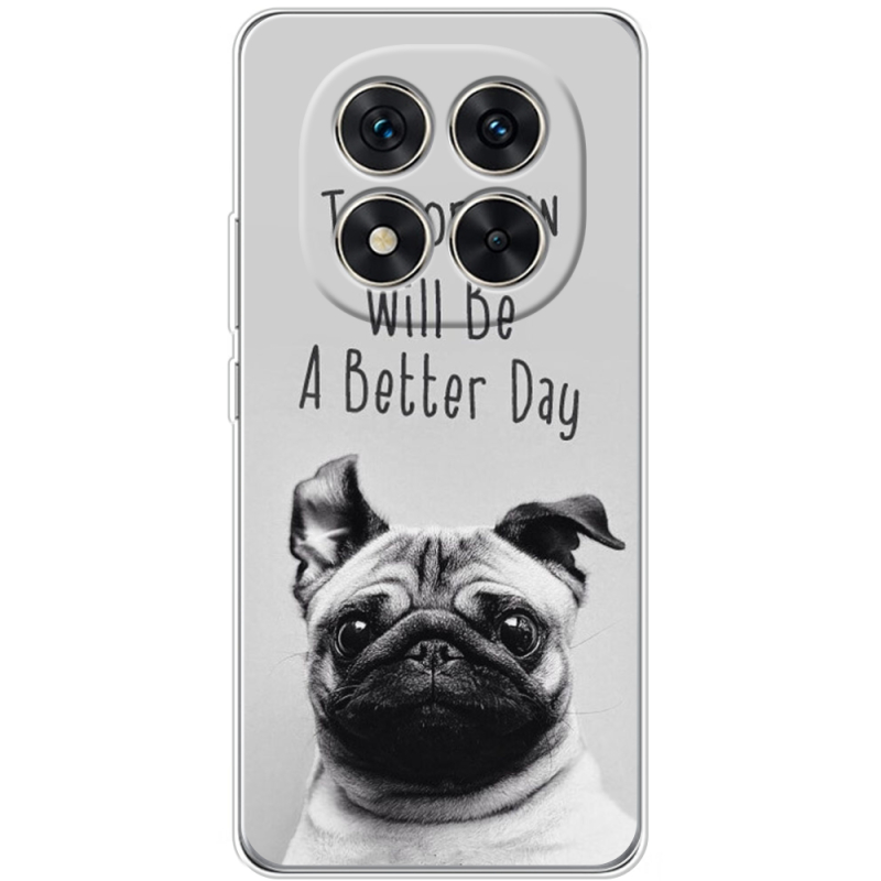 Чохол BoxFace Xiaomi Redmi Note 15 Pro 5G 