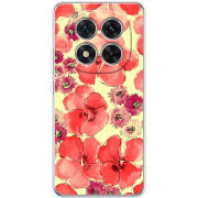 Чохол BoxFace Xiaomi Redmi Note 15 Pro 5G 