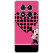 Чохол BoxFace Xiaomi Redmi Note 15 Pro 5G 