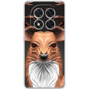 Чохол BoxFace Xiaomi Redmi Note 15 Pro 5G 