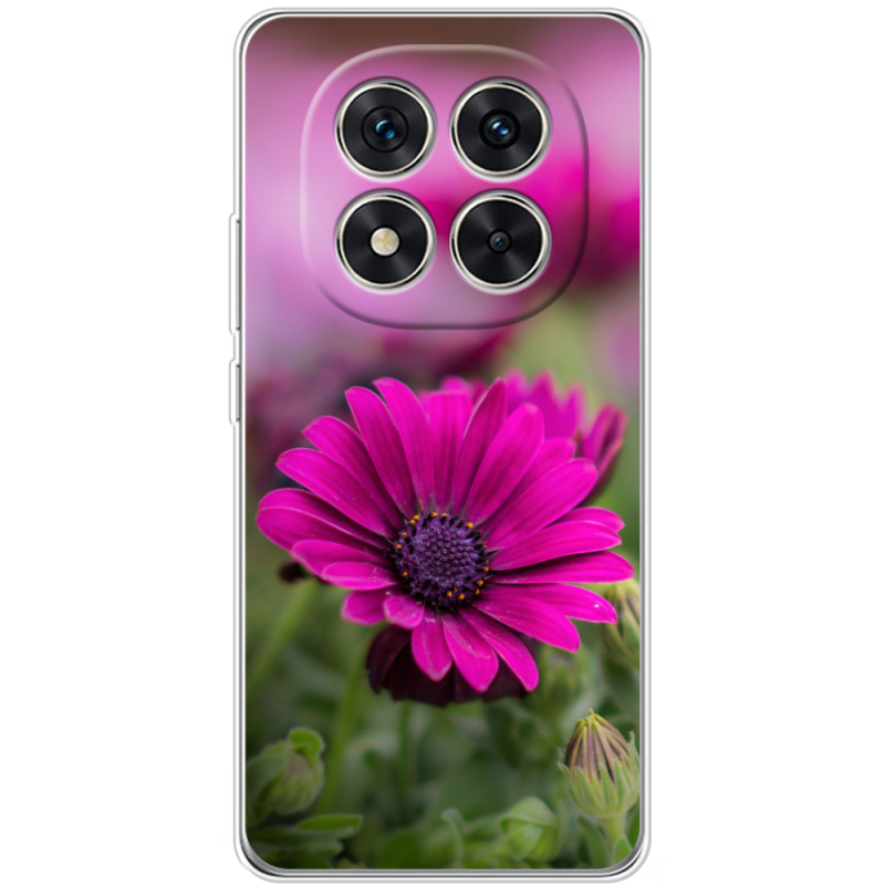 Чохол BoxFace Xiaomi Redmi Note 15 Pro 5G 