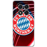 Чохол BoxFace Xiaomi Redmi Note 15 Pro 5G 