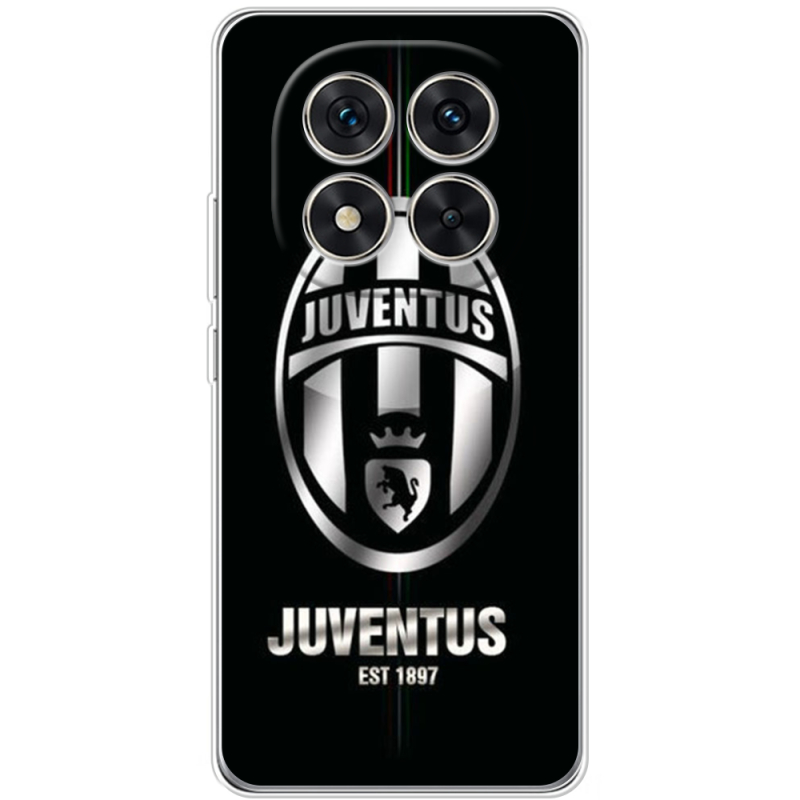 Чохол BoxFace Xiaomi Redmi Note 15 Pro 5G 