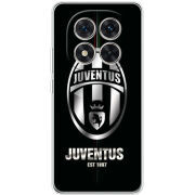 Чохол BoxFace Xiaomi Redmi Note 15 Pro 5G 