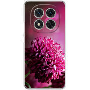 Чохол BoxFace Xiaomi Redmi Note 15 Pro 5G 