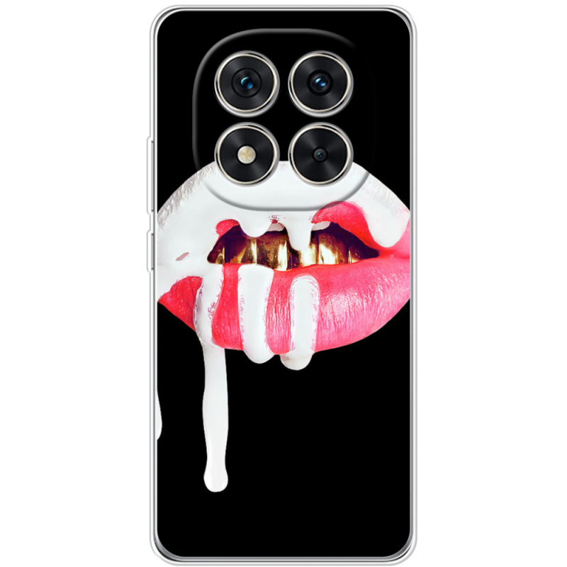 Чохол BoxFace Xiaomi Redmi Note 15 Pro 5G 