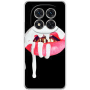 Чохол BoxFace Xiaomi Redmi Note 15 Pro 5G 