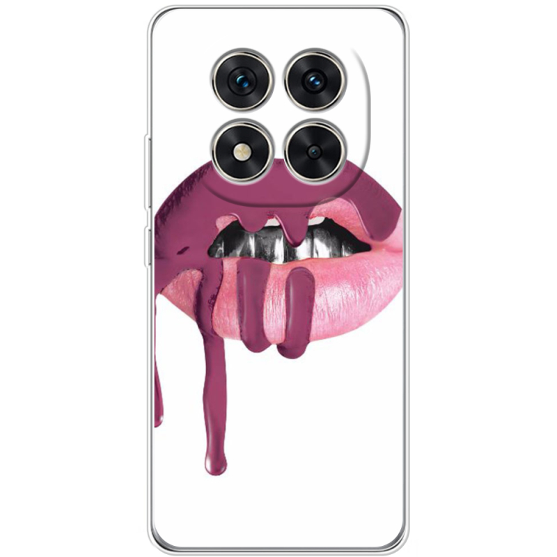 Чохол BoxFace Xiaomi Redmi Note 15 Pro 5G 