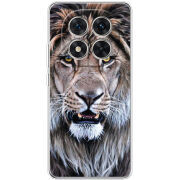 Чохол BoxFace Xiaomi Redmi Note 15 Pro 5G 