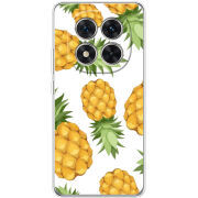 Чохол BoxFace Xiaomi Redmi Note 15 Pro 5G 