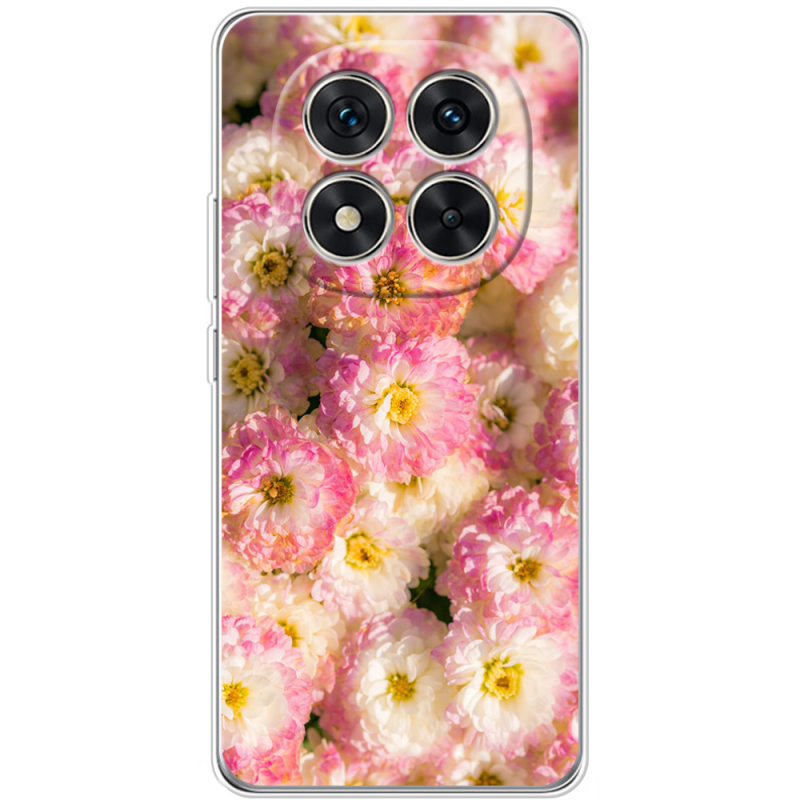 Чохол BoxFace Xiaomi Redmi Note 15 Pro 5G 