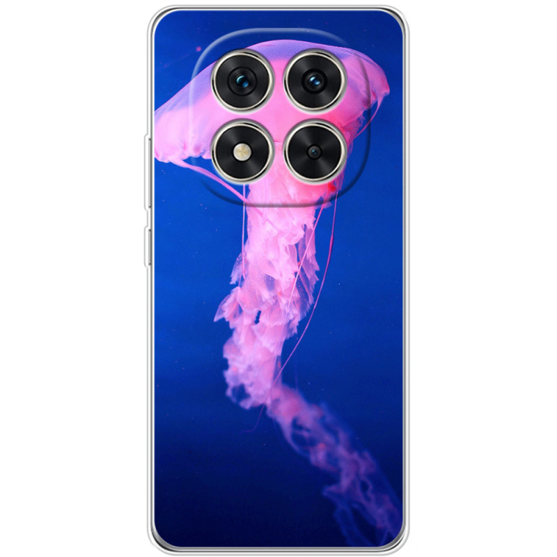 Чохол BoxFace Xiaomi Redmi Note 15 Pro 5G 