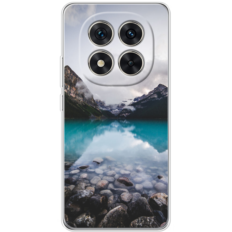 Чохол BoxFace Xiaomi Redmi Note 15 Pro 5G 