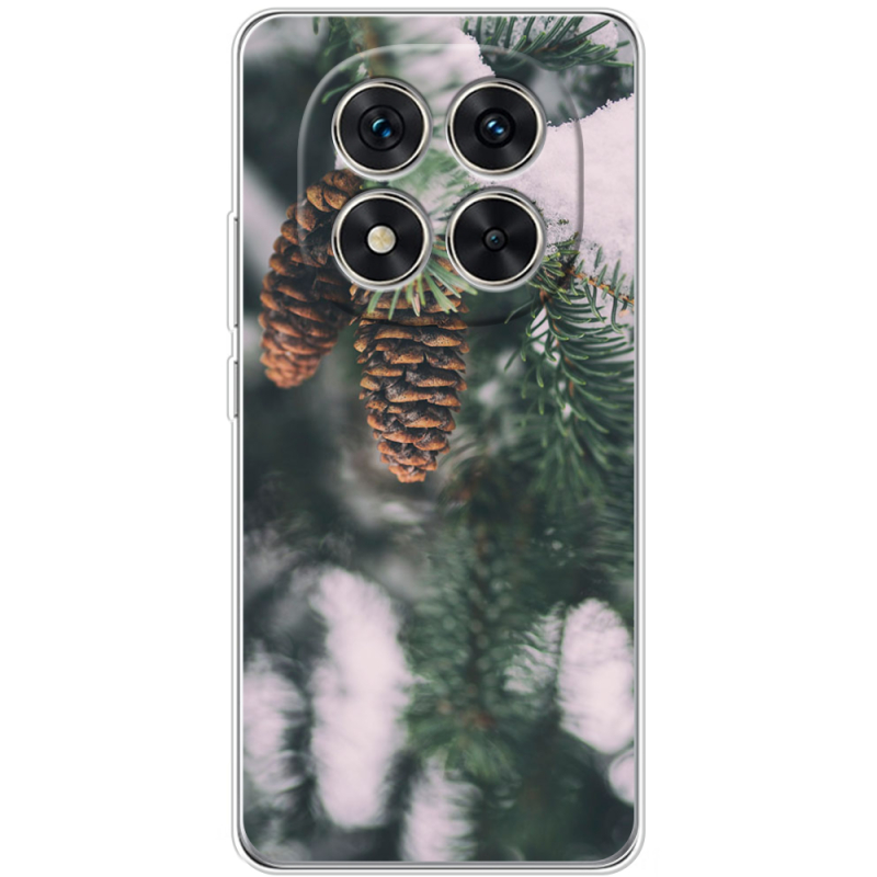 Чохол BoxFace Xiaomi Redmi Note 15 Pro 5G 