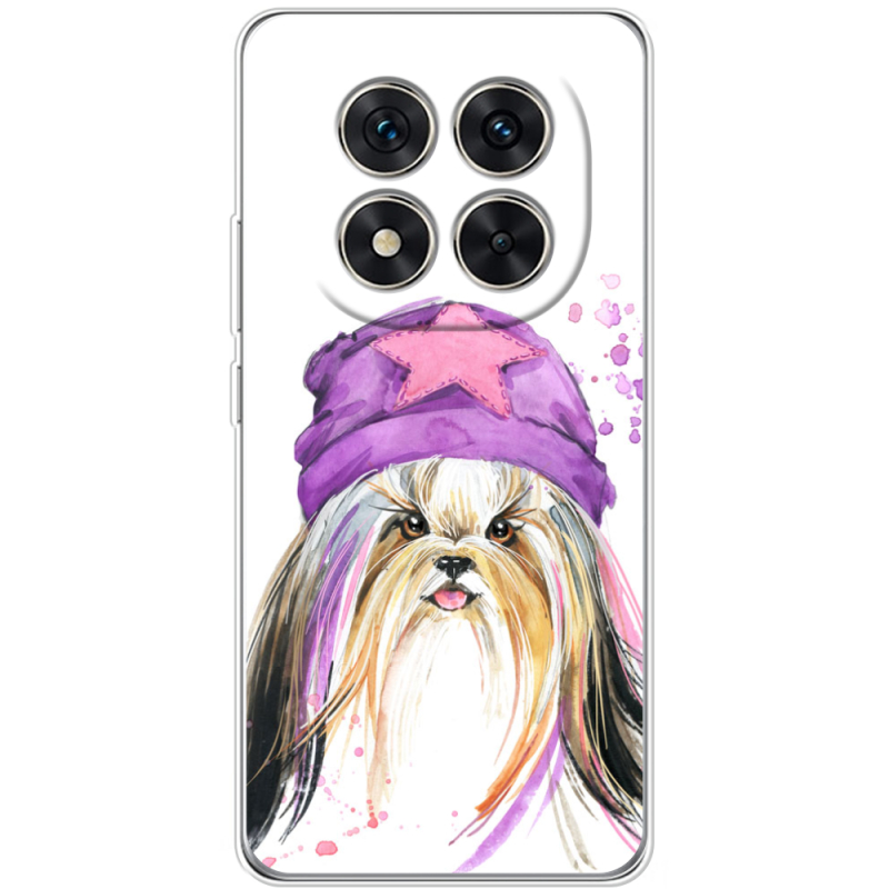 Чохол BoxFace Xiaomi Redmi Note 15 Pro 5G 