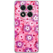 Чохол BoxFace Xiaomi Redmi Note 15 Pro 5G 