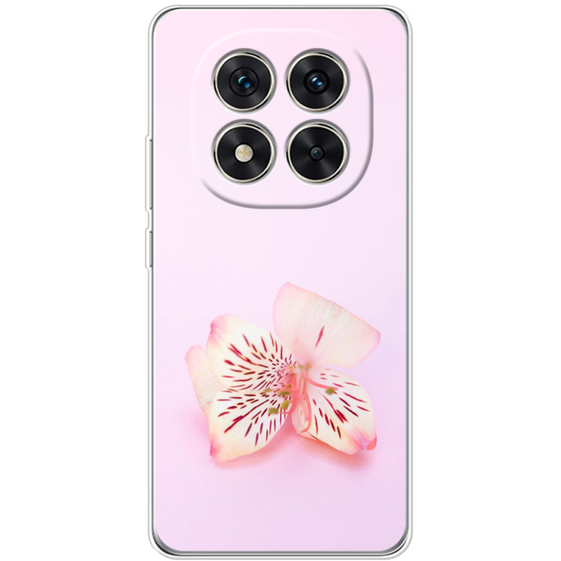 Чохол BoxFace Xiaomi Redmi Note 15 Pro 5G 