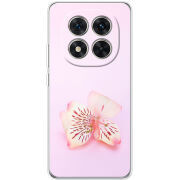 Чохол BoxFace Xiaomi Redmi Note 15 Pro 5G 