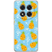 Чохол BoxFace Xiaomi Redmi Note 15 Pro 5G 