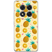 Чохол BoxFace Xiaomi Redmi Note 15 Pro 5G 