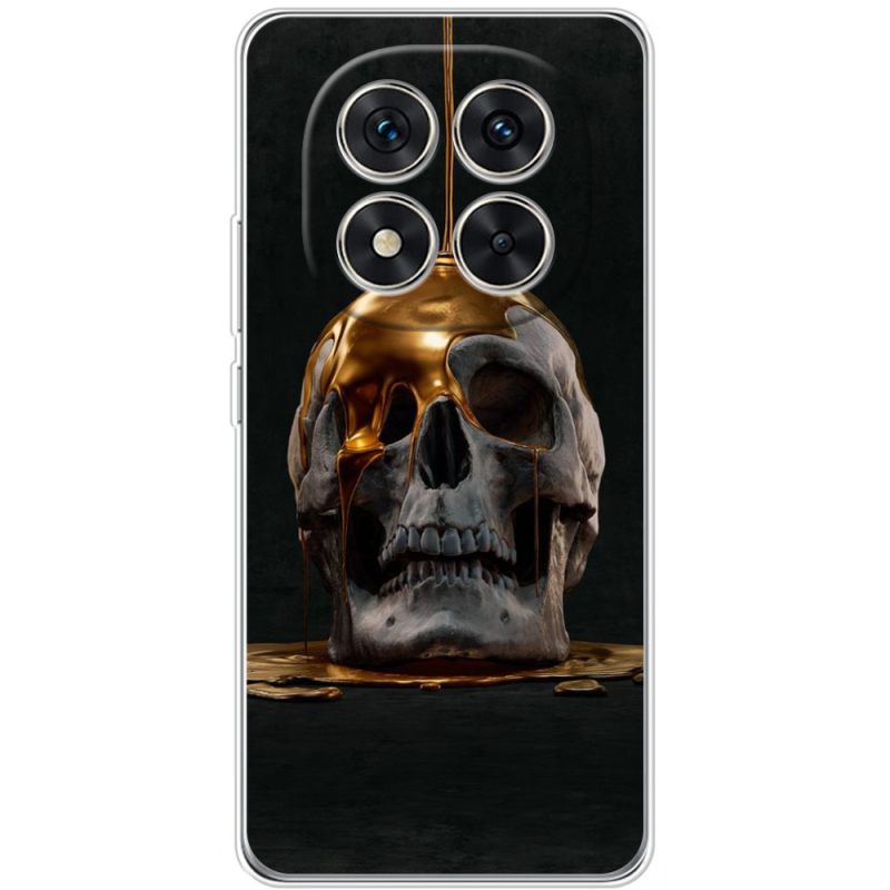 Чохол BoxFace Xiaomi Redmi Note 15 Pro 5G 