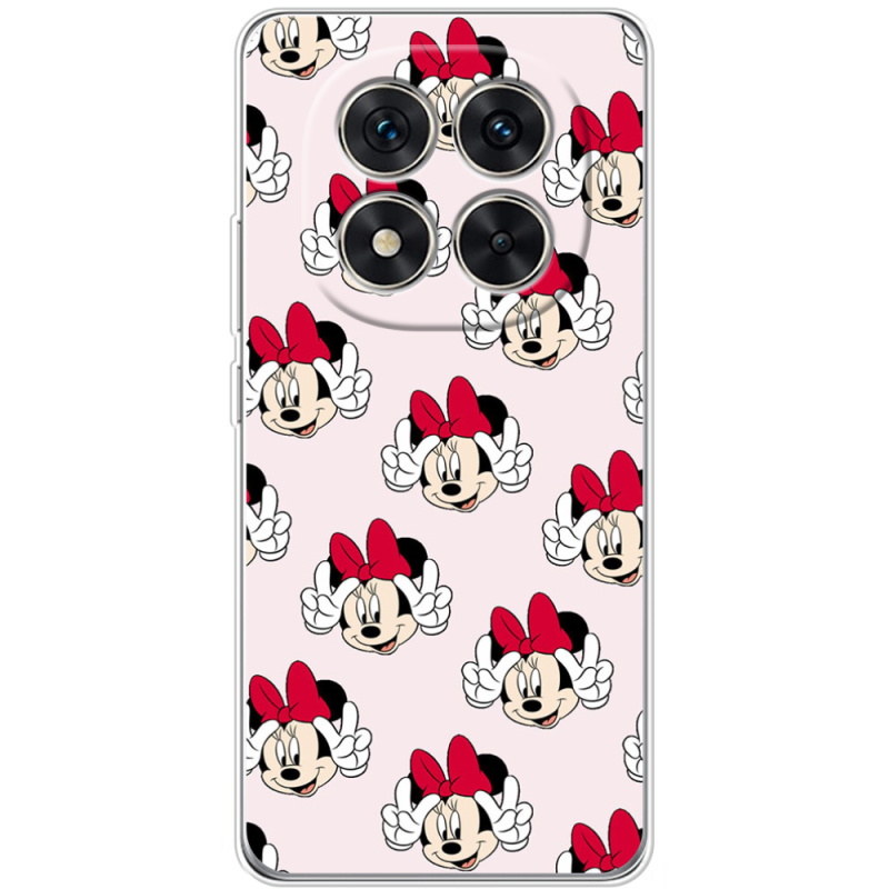 Чохол BoxFace Xiaomi Redmi Note 15 Pro 5G 