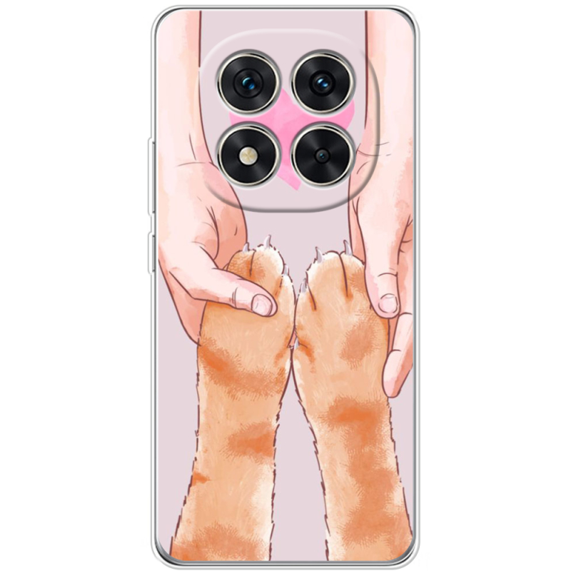 Чохол BoxFace Xiaomi Redmi Note 15 Pro 5G 