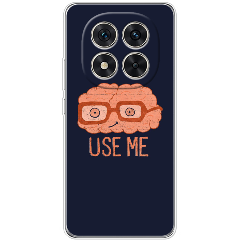 Чохол BoxFace Xiaomi Redmi Note 15 Pro 5G 