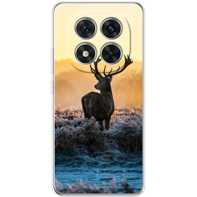 Чохол BoxFace Xiaomi Redmi Note 15 Pro 5G 