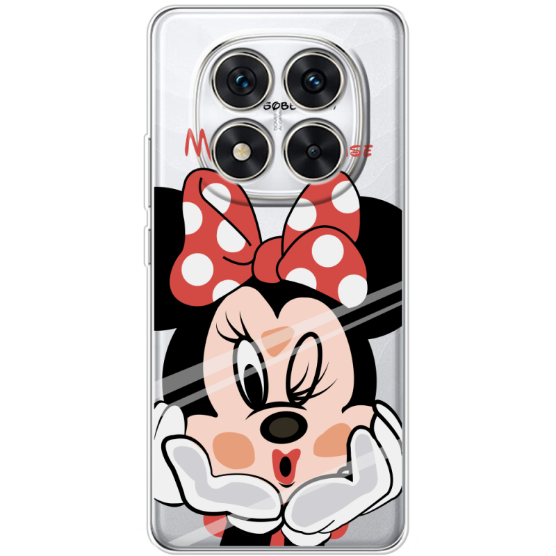 Прозорий чохол BoxFace Xiaomi Redmi Note 15 Pro 5G Lady M