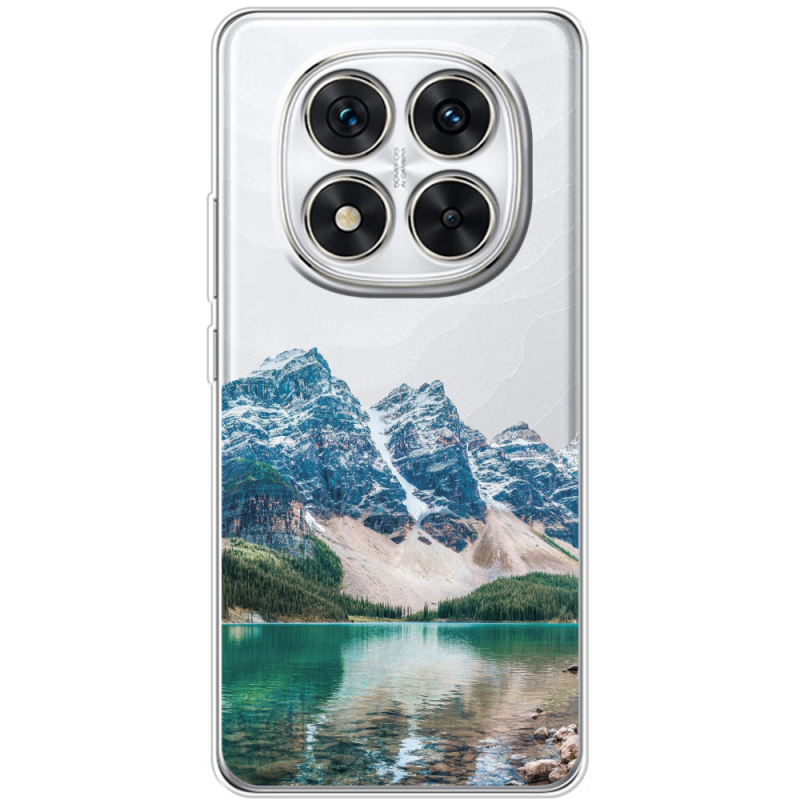 Прозорий чохол BoxFace Xiaomi Redmi Note 15 Pro 5G Blue Mountain