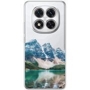 Прозорий чохол BoxFace Xiaomi Redmi Note 15 Pro 5G Blue Mountain