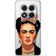 Прозорий чохол BoxFace Xiaomi Redmi Note 15 Pro 5G Фрида Кало