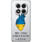 Прозорий чохол BoxFace Xiaomi Redmi Note 15 Pro 5G Моє серце в ритмі ЗСУ