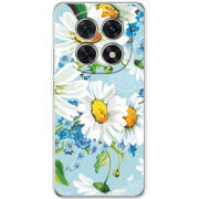 Чохол BoxFace Xiaomi Redmi Note 15 5G 