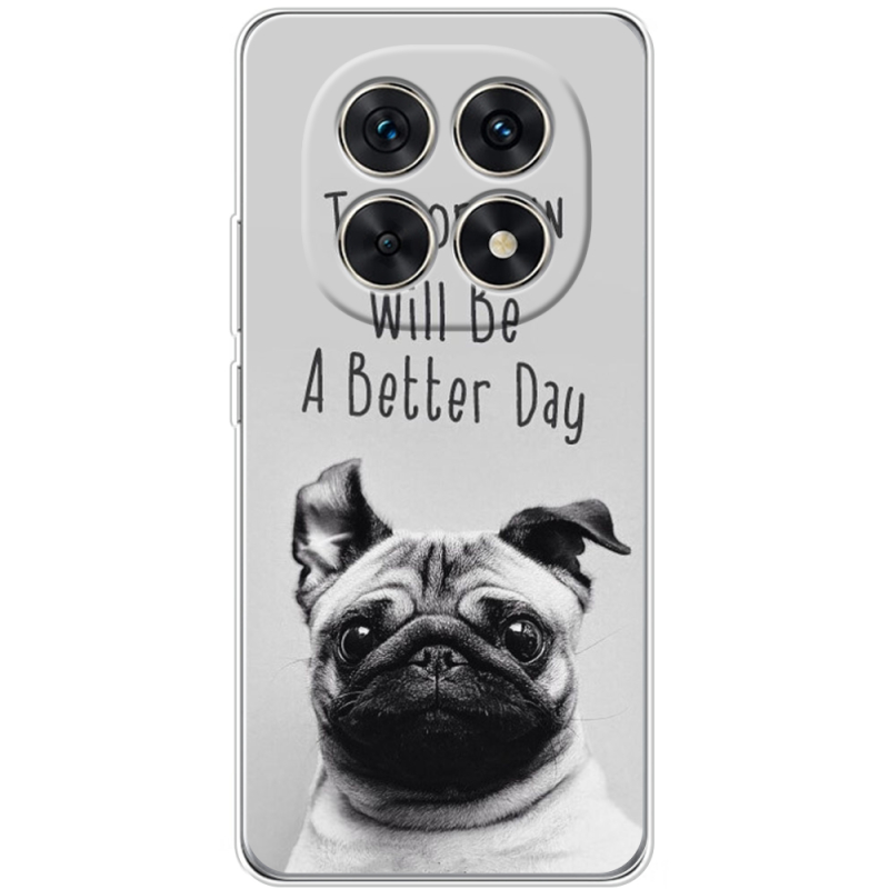 Чохол BoxFace Xiaomi Redmi Note 15 5G 