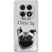 Чохол BoxFace Xiaomi Redmi Note 15 5G 