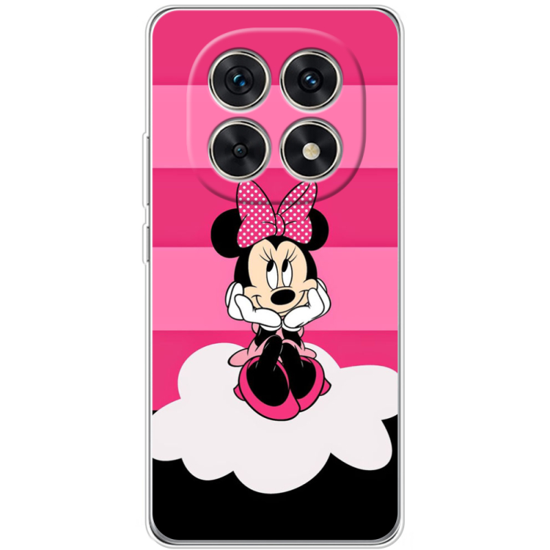 Чохол BoxFace Xiaomi Redmi Note 15 5G 