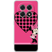 Чохол BoxFace Xiaomi Redmi Note 15 5G 