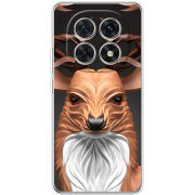 Чохол BoxFace Xiaomi Redmi Note 15 5G 