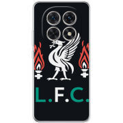 Чохол BoxFace Xiaomi Redmi Note 15 5G L. F. C.