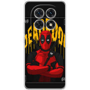 Чохол BoxFace Xiaomi Redmi Note 15 5G 