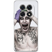 Чохол BoxFace Xiaomi Redmi Note 15 5G 