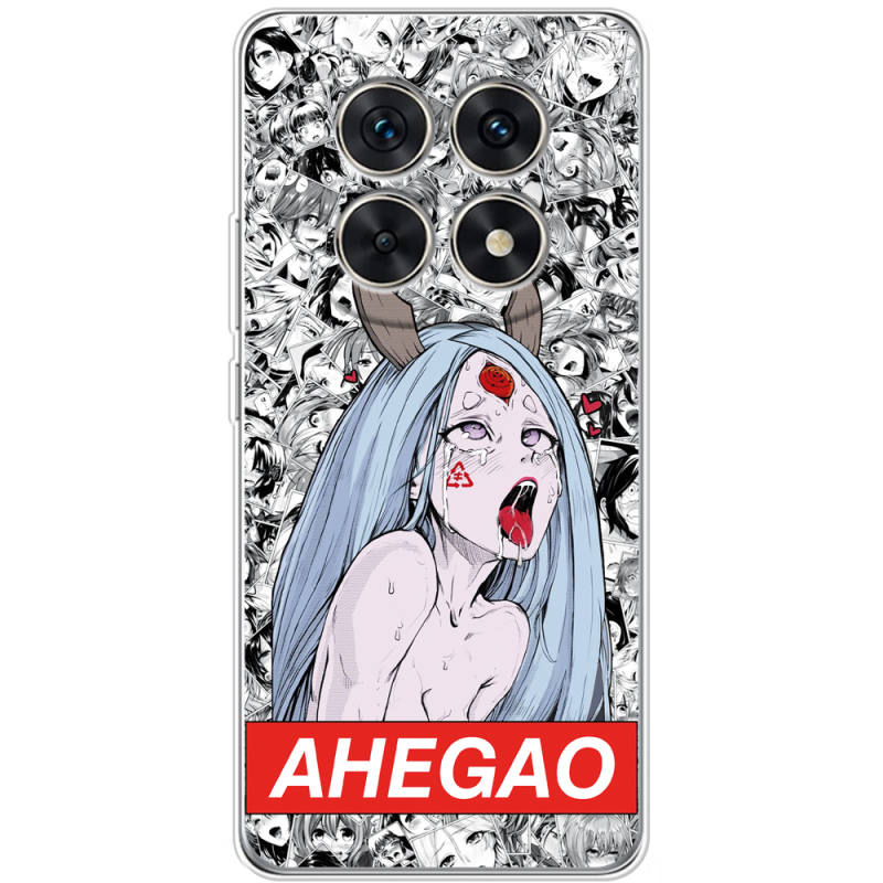 Чохол BoxFace Xiaomi Redmi Note 15 5G Ahegao