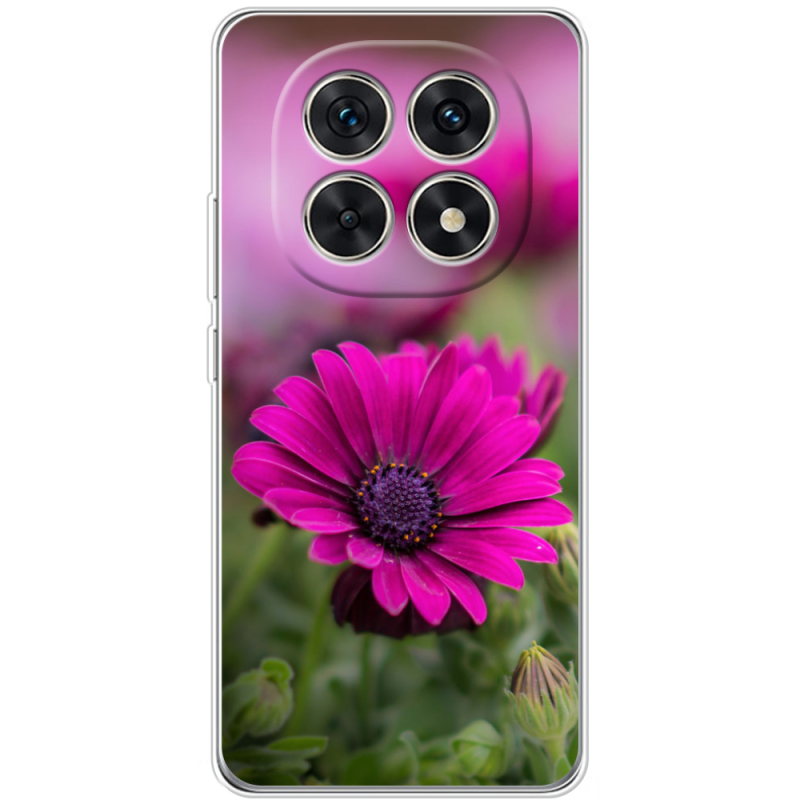 Чохол BoxFace Xiaomi Redmi Note 15 5G 