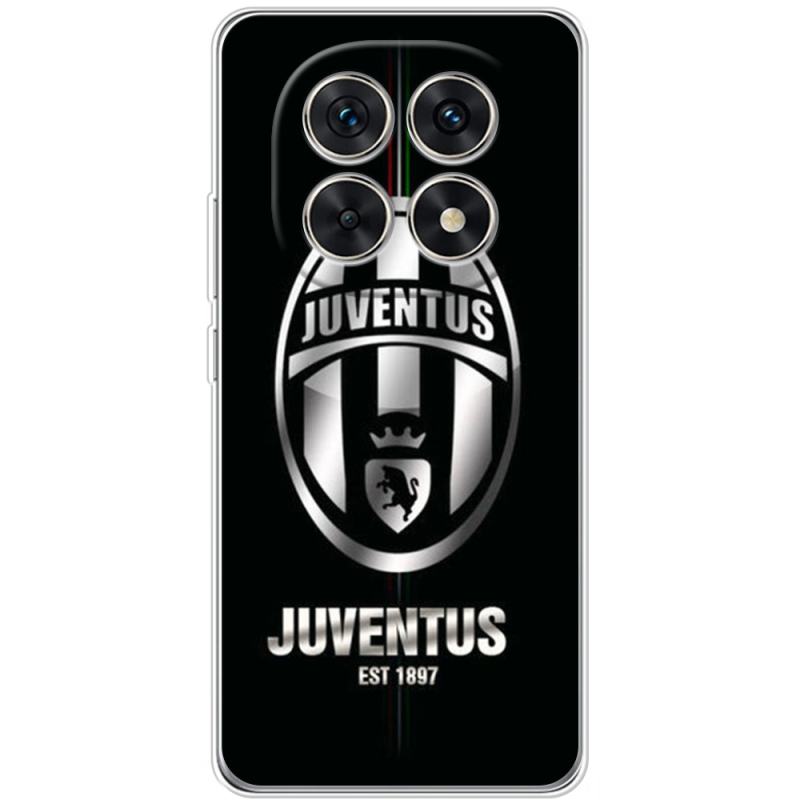 Чохол BoxFace Xiaomi Redmi Note 15 5G 