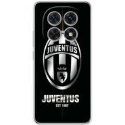 Чохол BoxFace Xiaomi Redmi Note 15 5G 