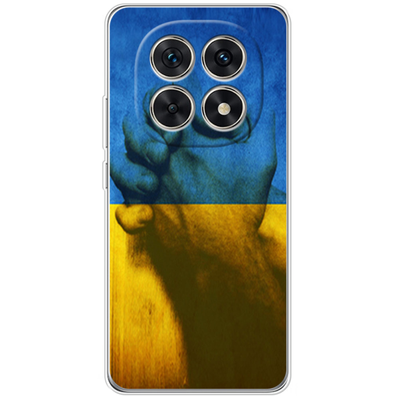 Чохол BoxFace Xiaomi Redmi Note 15 5G Handshake